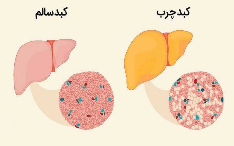 نشستن زیاد در کودکی دشمن کبد